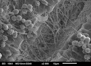 Paweł Nakielski Electrospinning Nanofiber Cells Scaffold Tissue Engineering Regeneration Drug Delivery Blood Cloting Fibrin Fibrinogen PLA PCL PLCL Red Cells Thrombin Hemostasis